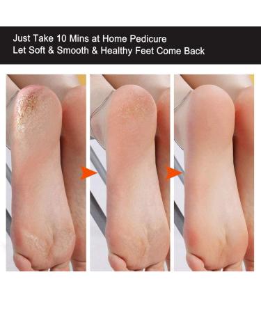 MAKARTT Fine Callus Remover - Premium Pedicure Foot File for Coarse Skin | International Shipping Available - Buy Online on GoSupps.com
