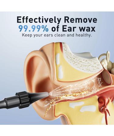 Lebbtl Ear Wax Removal - Electric Ear Irrigation Flushing System Ear Cleaner with Camera 1080P Otoscope Ear Cleaning Tool with 7 Pcs Ear Set Safe and Effective Earwax Removal Kit Black - Buy Online on GoSupps.com