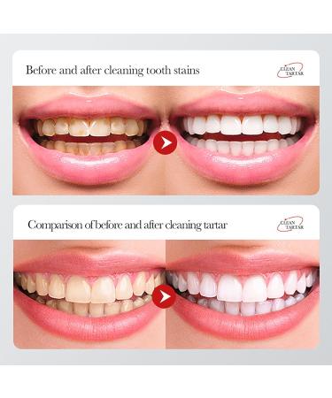 BIOAQUA 1.5X Instant Whitening Toothpaste - Whiten Teeth Protect Enamel & Freshen Breath - 100g | Global Shipping Available - Buy Online on GoSupps.com