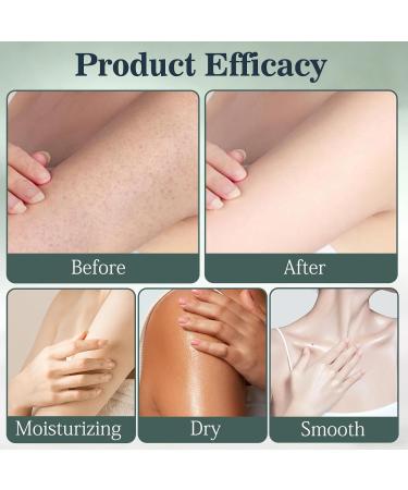 2PCS Intertrigo Cream Intertrigo Relief Cream Skin Fold Care & Chafing Support Cream Moisture and Friction Control Quickly Soothes Skin Fast-Drying Non-Greasy Formula for Friction-Prone Areas - Buy Online on GoSupps.com