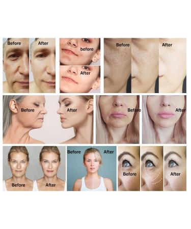 Pure Hyaluronic Acid Serum - Brightening & Moisturizing for Face | Reduce Dry Skin Wrinkles Dark Spots - Aloe Vera Extract - 1oz - Sensitive Skin Safe - Buy Online on GoSupps.com