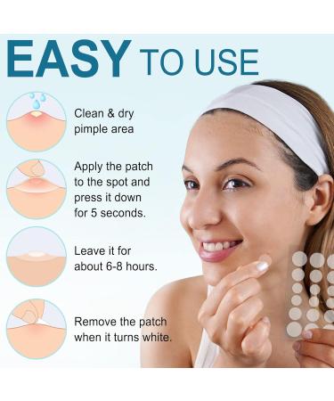 L otFancy Acne Patches 240 Count - Hydrocolloid Pimple Patches for Face - 3 Sizes for Blemishes & Spots - Skin Acne Dots Treatment - Buy Online on GoSupps.com