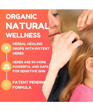 Natural Lice Treatment with Powerful Herbs - Extra Strength for Family and Kids - Buy Online on GoSupps.com