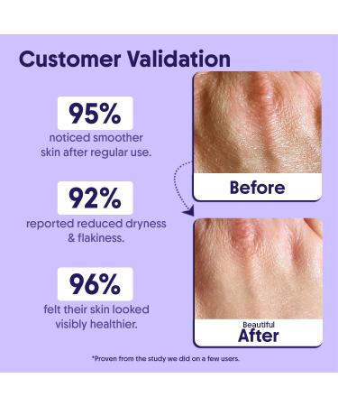 Aravi Organic De-Tan Body Lotion Combo | AHA BHA Body Lotion for Skin Renewal & SPF 50 PA++++ Sunscreen for Tan Protection | Hydrating Formula | For Men & Women | 200ml - Buy Online on GoSupps.com