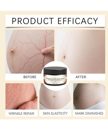  G n rique Stretch Mark Cream for Pregnancy | 50g Pregnancy Belly Care | Non-Greasy Texture Prevents Stretch Marks and Improves Skin Elasticity | Moisturizing and Preventative - Buy Online on GoSupps.com