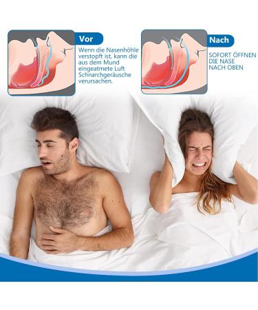 80 Nasal Strips for Snoring Relief | Breathe Easy with Nose Paving | Allergy & Sleep Aid - Buy Online on GoSupps.com