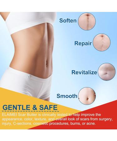 Scars Cream - 20g Light Butter Non Sticky Body Cream Butter Stick For Scars Burn | For Hands Legs Knees Neck Burn Buttons Women Face Body - Buy Online on GoSupps.com