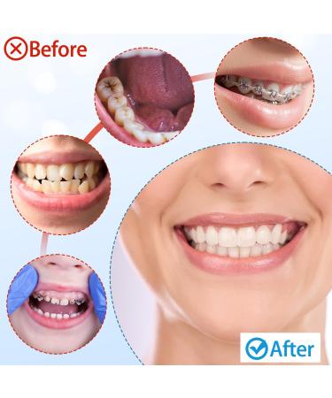 Interdental Toothbrush Set - Soft Fragrant Brushes for Orthodontic Care (2 Pack White/Pink) - Buy Online on GoSupps.com