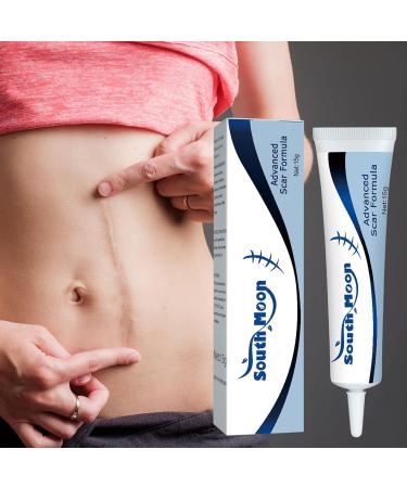 NGUMMS Scar Anti-Scar Cream for Scar Removal | Moisturizing Healing Treatment for Caesarean Section Stretch Marks Surgical Scars Effective - Buy Online on GoSupps.com