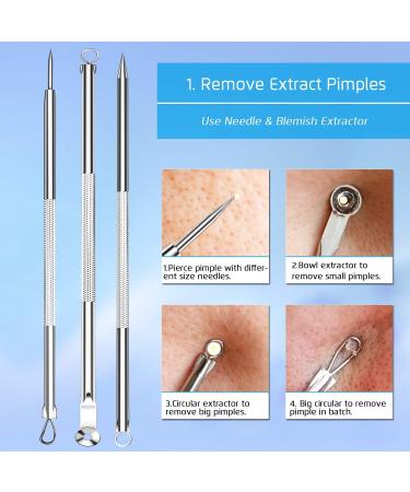 Blackhead and Acne Removal Kit with Tweezers - Pimple Comedone Extractor Tool for Face, Forehead, and Nose - Blemish and Whitehead Treatment - Buy Online on GoSupps.com