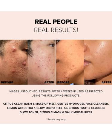 Nudestix 3-Step Citrus Renew Set for Makeup Travel-Size Skincare Kit with Cleansing Balm Exfoliator & Moisturizer/Primer - Buy Online on GoSupps.com