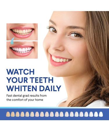 LUELLI Teeth Whitening Kit - 5X LED Tooth Whitener with 12ml Serum for Bright Smile - Buy Online on GoSupps.com