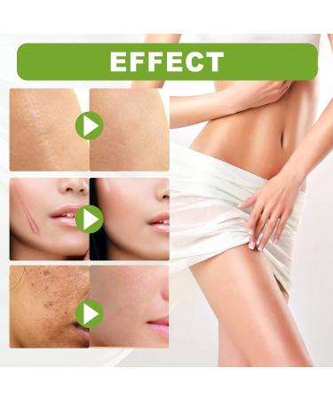 Goopgen Advanced Scar Repair Serum - Intensive Scar Treatment (1PC) - Buy Online on GoSupps.com