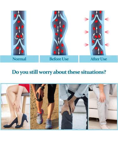 Ktinnead Compression Socks for Women & Men | 20-30 mmHg Knee High Opaque Graduated Stockings | Unisex Open Toe in Beige - Medium Size - Buy Online on GoSupps.com