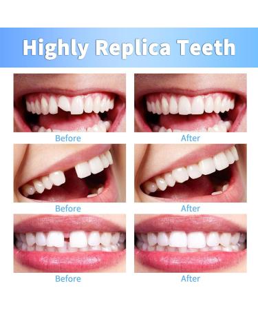 Provisional Denture Repair Set | Temporary Plastic Tooth Solutions for Halloween & Christmas - Buy Online on GoSupps.com