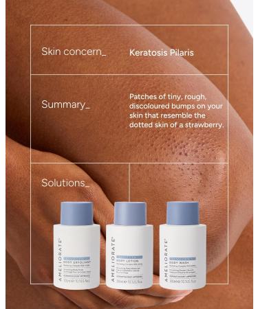  AMELIORATE AMELIORATE Transforming Body Lotion 300 ml for Keratosis Pilaris (KP) Rough Bumpy Skin & Ingrown Hairs | Exfoliating Moisturiser with Lactic Acid (AHA) | Dermatologist Approved & Pregnancy Safe - Buy Online on GoSupps.com