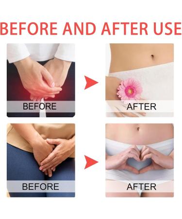 Jacekee Itching Relief Cream for Genital Area | Soothing Anti-itch Cream for Dryness Burning & Redness - Fast Shipping Worldwide - Buy Online on GoSupps.com