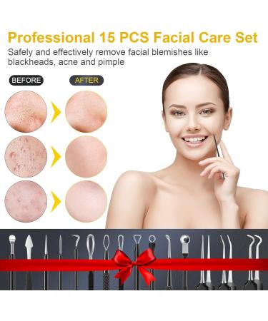 Pimple Popper Tool Kit - 15 PCS Professional Stainless Steel Blackhead Remover Set for Acne Removal - Includes Metal Case - Black - Buy Online on GoSupps.com