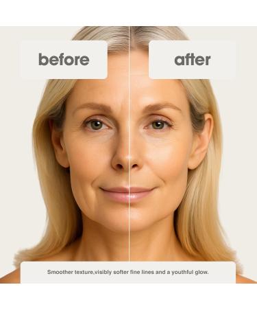 Skinco Age Reset Advanced Retinol Serum Professional Strength Formula with Hyaluronic Acid Vitamin E & Botanical Extracts | Smooths Fine Lines Firms & Brightens Skin (1 fl oz) - Buy Online on GoSupps.com