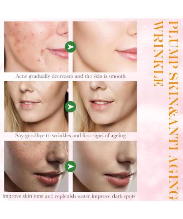 Skincare Set Gfits For Women & Girls Skin Care Pamper Gifts For Her Includes Vitamin C Serum Hyaluronic Acid Retinol Serum -Boost Skin Collagen Hydrate Plump Skin Anti Aging & Wrinkle - Buy Online on GoSupps.com