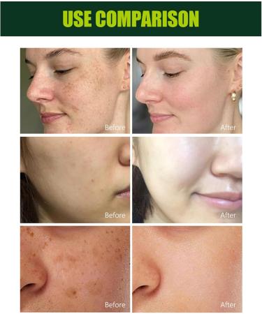 arbutin face cream for even skin tone face cream face cream for face arbutin - Buy Online on GoSupps.com