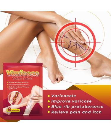 40 Sheets Varicose Veins Treatment Patches | Herbal Extract Spider Vein Removal | Improve Blood Circulation | Portable Solution - Buy Online on GoSupps.com