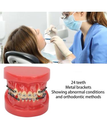 Orthodontic Demonstration Model | Professional Dental Model with Metal Wires & Brackets for Learning | International Shipping Available - Buy Online on GoSupps.com