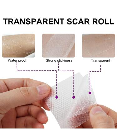 Joyeee Silicone Scar Tape Roll for Professional Scar Removal - Reusable Self Adhesive Silicone Strips for C-Section Surgery, Burn, Keloid, Acne - 1.6 x 60 - Buy Online on GoSupps.com