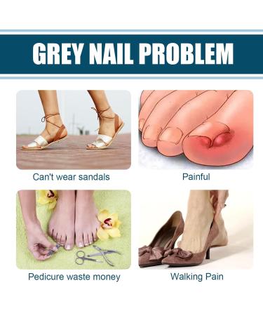 Nail Repair Cream for Damaged Nails | Strengthener for Thin & Cracked Nails | Boost Growth & Strengthen Weak Nails - Buy Online on GoSupps.com