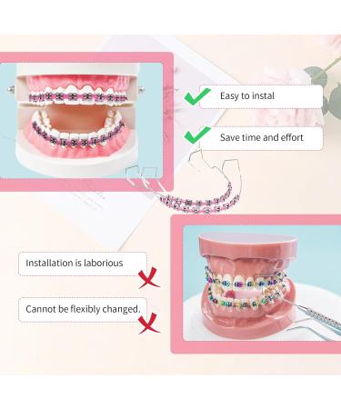 Brackets Falsos Para Dientes Kit 2 Pack Braces Kit with Brackets & Wire & Glue Brackets Para Dientes DIY Retainer for Teeth Dental Student Practice Props (Pink) - Buy Online on GoSupps.com