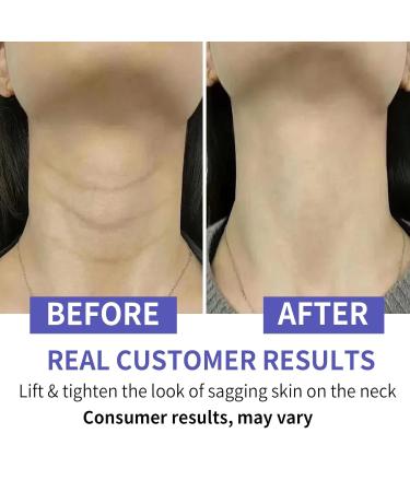 Neck Firming Cream - Advanced Anti-Aging Cream for Tightening Wrinkle Reduction & Even Skin Tone | Repair Complex for Decolletage & Double Chin - Buy Online on GoSupps.com