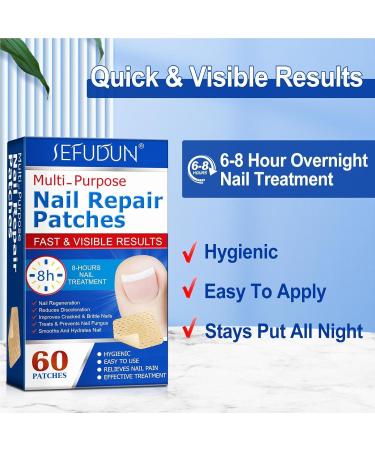 Nail Repair Plaster Nail Repair Kit For Broken Natural Nails Extra Strength Treatments For Damaged Nails Non-irritating Breathable Toenail Correction Treatments - Buy Online on GoSupps.com