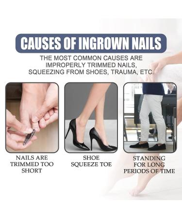 German Toenailcare Removal Paronychia Oil - 2 Pcs Set for Ingrown Toenail Treatment and Softening Embedded Toenails - Buy Online on GoSupps.com