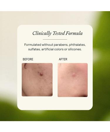 EQ Daily Moisturizer - EGCG + Quercetin - Hydrating Face Cream - For Dry Skin, Redness & Blemishes - With Jojoba & Squalene Oil - Lightweight Plant-Based Formula - 0.5 fl oz 0.5 Fl Oz (Pack of 1) - Buy Online on GoSupps.com