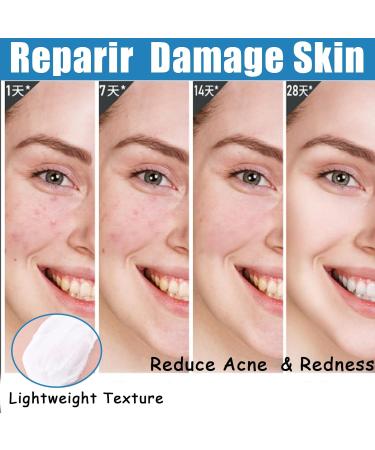 Repair Face Cream Smoothing Day Cream Anti Redness Moisturiser Cream Firming Face Cream For Sensitive Skin Face Moisturizer For Women & Men Vitamin B5 Cream For Acne Brightening & Repair Damage Skin - Buy Online on GoSupps.com