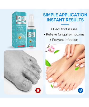 Natural Athlete's Foot Treatment Spray for Feet Itch, Sweat, Peeling & Blisters - Buy Online on GoSupps.com