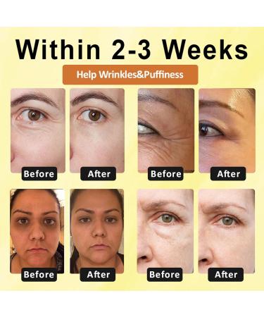 dooeka ApisHeal VenomBoost Collagen Eye Cream Eye Cream Anti Aging ApisHeal Instant Eye Firm Cream Instant Reduces Under Eye Bags Dark Circles Puffiness Anti Aging Fine Lines (1 Bottle) - Buy Online on GoSupps.com