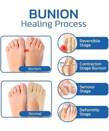 5 Pairs Sockalign USA Toe Socks for Bunion Relief - Women s Compression Bunion Socks - Buy Online on GoSupps.com