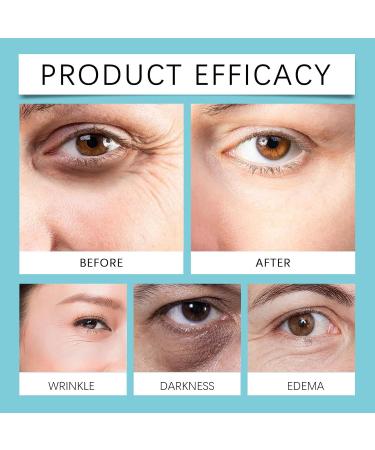 Fold Reducing Tight Eye Cream - Regenerating Anti-Aging Eye Care & Moisturizing Lifting Cream (2PCs) - Best Eye Anti-Aging Solution - Buy Online on GoSupps.com