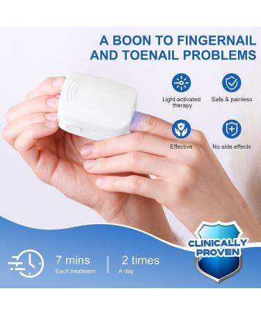 Nail Fungus Laser Treatment Device - Home Use Onychomycosis & Fungus Cleaning Treatment for Fingernails & Toenails - 910nm Infrared & 470nm Blue Light - Buy Online on GoSupps.com