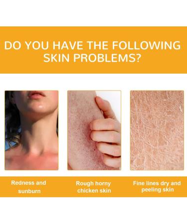 200ML Essential Oils for Skin Vitamin C Body Oil Vitamin C Facial Oil Gel Vitamin C Oil for Skin Body Oil for Women Body Oil Body Oil Gel Body Oil Moisturiser Body Oil for Dry Skin Dry Body Oil - Buy Online on GoSupps.com