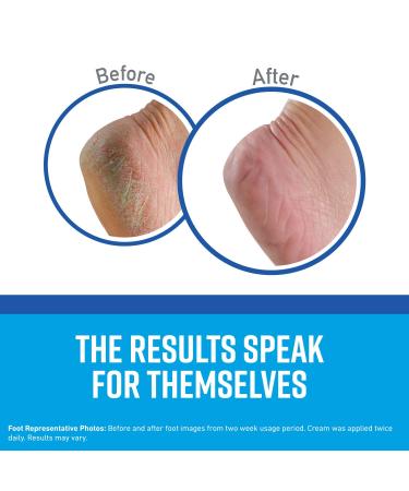 O'Keeffe's Healthy Feet Foot Cream 3.2 oz - Deep Moisture & Repair - Buy Online on GoSupps.com
