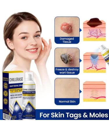 Face | 60ml Refreshing and Soothing for Blemish Renewal - Refreshing and Soothing Moisturizing Spray Day and Night Care for Redness on Face and Body - Women - Buy Online on GoSupps.com