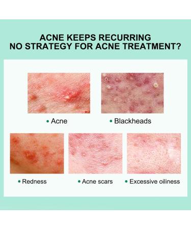 Anti Acne Face Cream & Dark Spot Remover for Face Acne Cream Spot Cream For Acne & Spot Anti Acne Spot For Face Back Inner Thigh Butt Blackhead Remover Cream for Face & Back Acne Anti-Blemish Care - Buy Online on GoSupps.com