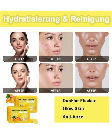  MEITREND Tourmeric Kojic Acid Lemon Turmeric Soap for Removing Dark Spots from Face and Body Turmeric and Kojic Acid Soap Lemon Shine Soap - Cleanser - 2 Pack - Buy Online on GoSupps.com