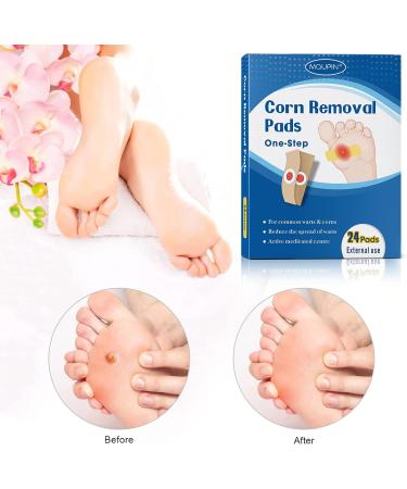 MQUPIN Corn Remover Pads Wart Remover Pads Foot Corn Remover Pads Plantar Wart Removal Corn Callus Remover Penetrates and Removes Common and Plantar Warts with Hole Callus Stops Wart Regrowth (24 PCS) - Buy Online on GoSupps.com