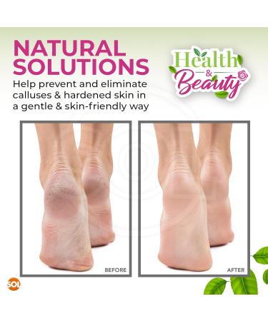 8pk Natural Pumice Stone for Feet | Callus Remover Feet Scrubber Dead Skin Pumice Stones | Foot Scrubber Pumice Stone Feet | Foot Pumice Stone for Hands Foot Stone Pumice for Hard Skin + SOL Sticker - Buy Online on GoSupps.com