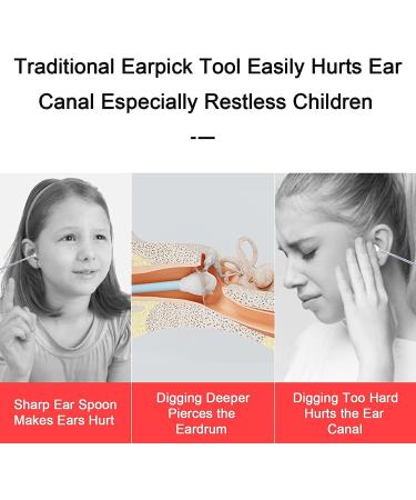 BEBIRD R1 Ear Wax Removal Tool Camera Endoscope - 1080P HD Wireless Ear Cleaner with 6 LED Lights for iPhone, iPad, Android - Kids, Adults & Pets (Black) - Buy Online on GoSupps.com