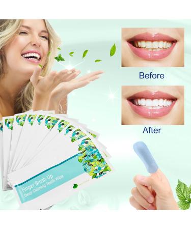 100 Pack EZGO Deep Cleaning Teeth Wipes Finger Brush - Mint Flavor, Latex Free - Buy Online on GoSupps.com