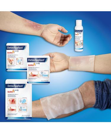 DetectaPlast Incineration Kit - Complete Burn Care Set with Sterile Hydrogel Compresses Fire Gel Bandages & Gloves for Instant Relief - Buy Online on GoSupps.com